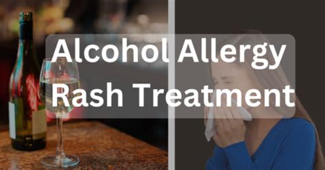 Alcohol Allergy Rash Treatment Complete Guide | United Recovery ...