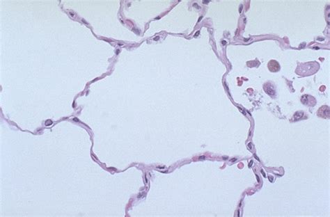 Alveolar Epithelium Histology