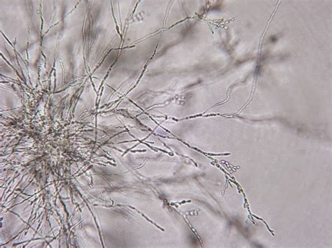 Fun With Microbiology (What's Buggin' You?): Trichosporon species