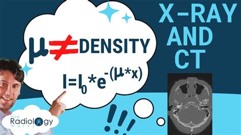 X-ray Attenuation Coefficients | X-ray Attenuation Calculator | A level ...