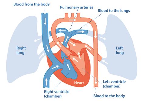 What is pulmonary hypertension? | Asthma + Lung UK