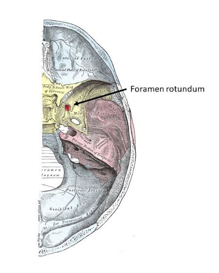 The foramen rotundum is located within what bone? a. parietal b ...