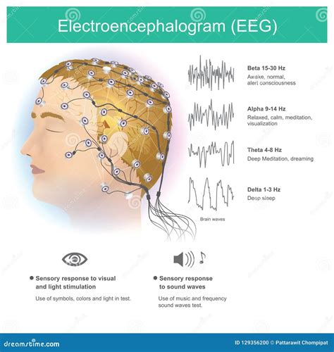 Electroencephalogram EEG. Anatomy Human Brain. Stock Illustration ...