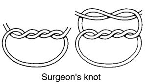 Surgeon's knot | definition of surgeon's knot by Medical dictionary