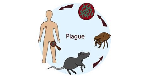 Plague: Types, Symptoms, Causes, Prevention and Treatments