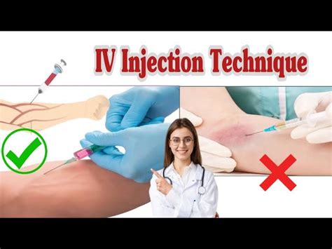 Intravenous Injection