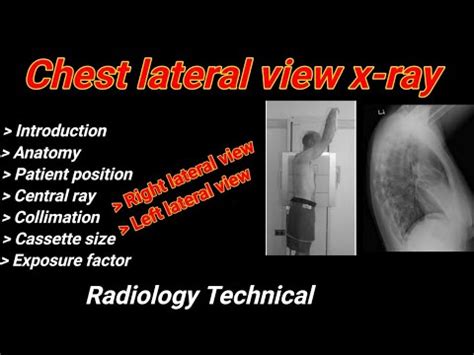 Chest Lateral view X-ray # Right & Left lateral projection # Chest ...