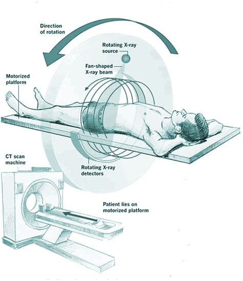 CECT Abdomen Cost, Procedure, Precautions & Purpose [2024]