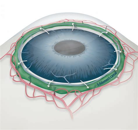 How eyes get clogged in glaucoma and how to f | EurekAlert!