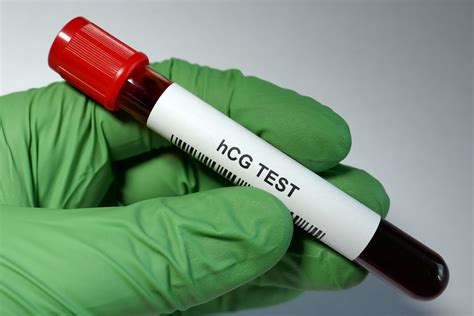 Pregnancy Blood Test: Types, Purpose, and Importance