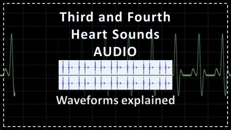 S3 and S4 | Third and Fourth Heart Sounds Audio and Explanation | S3 ...