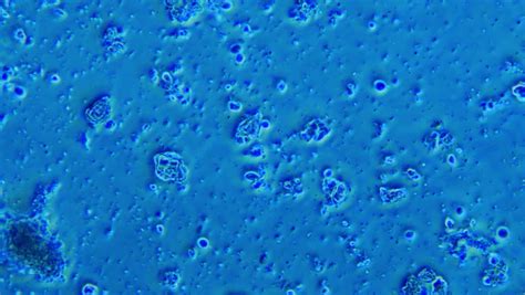 Dental Plaque From Human Sample Seen In Phase Contrast Microscope 800x ...