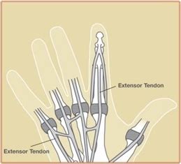 Extensor Tendon Injuries | Houston Tendon Treatment