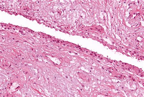 Synovial Membrane Histology