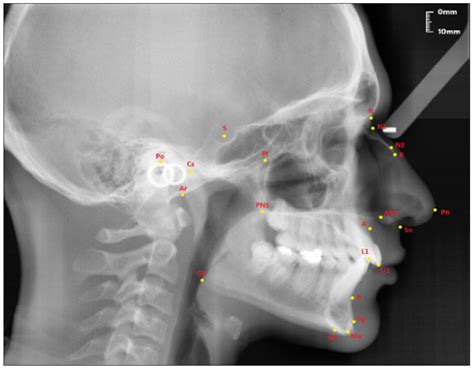 Diagnostics | Free Full-Text | Investigation of the Relationship ...