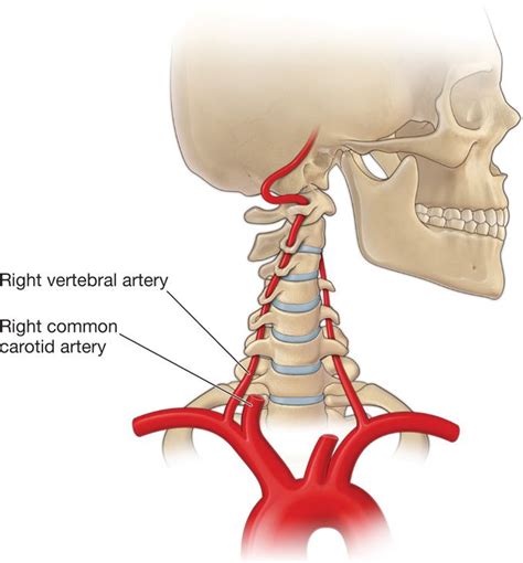 Vascular Complications of Spinal Interventions | Anesthesia Key