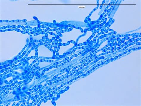 Fun With Microbiology (What's Buggin' You?): Trichosporon species