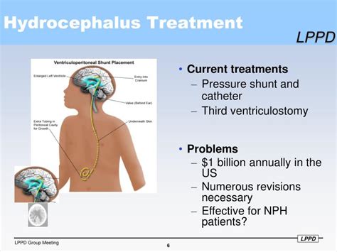 PPT - Measurements and Computational Modeling of Cerebrospinal Fluid ...