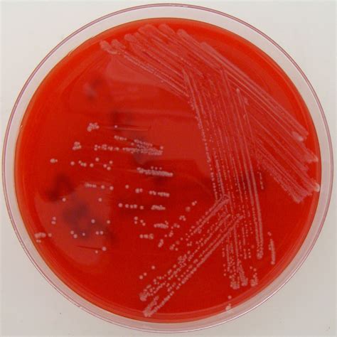 Corynebacterium diphtheriae on Columbia Horse Blood Agar | Flickr