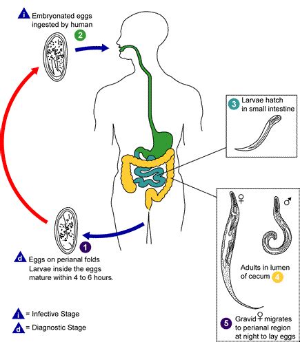 Enterobiasis pathophysiology - wikidoc