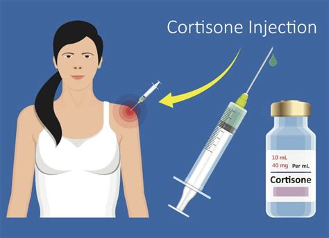 Are Cortisone Injections Bad for You? - Sport Doctor London