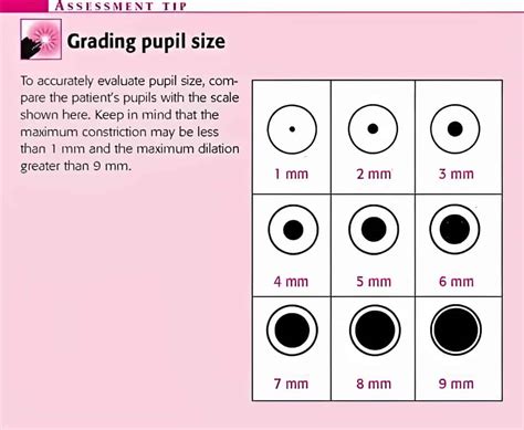 Pupil Size Chart Printable | Portal.posgradount.edu.pe