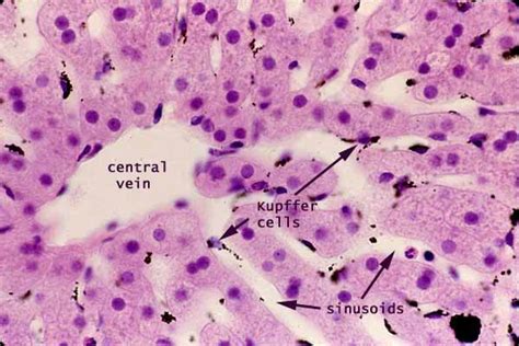 Liver Histology Kupffer Cells