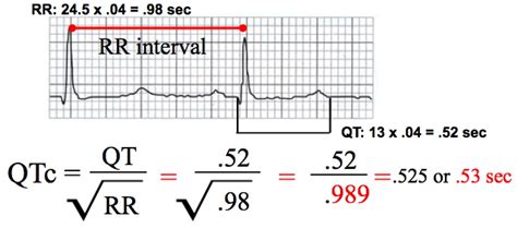 QT Interval Corrected Measurement