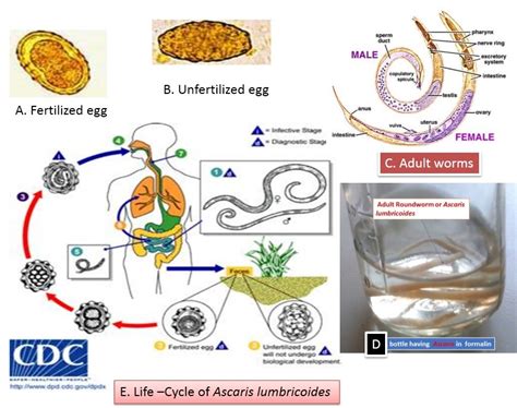 Ascaris: Introduction, Morphology, life cycle, mode of infection, Pathogen