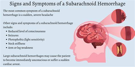 뇌출혈 지주막하출혈 거미막하출혈 SAH subarachnoid hemorrhage 증상 원인 치료 수술 예후 합병증 ...