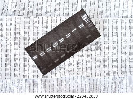 Dna Sequence Electrophoresis Photo Restriction Map Stock Photo 73145722 ...