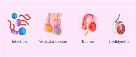 Causes of non-communicating hydrocele