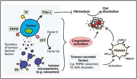 Cancers | Free Full-Text | Cancer-Associated Thrombosis: An Overview of ...