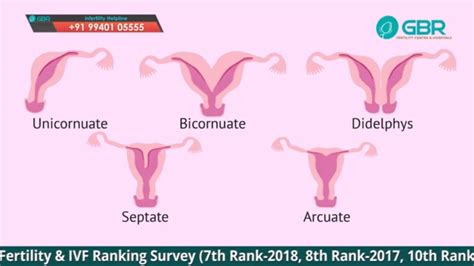 Uterine Septum Symptoms & Pregnancy | GBR Cord | DR G Buvaneswari - YouTube