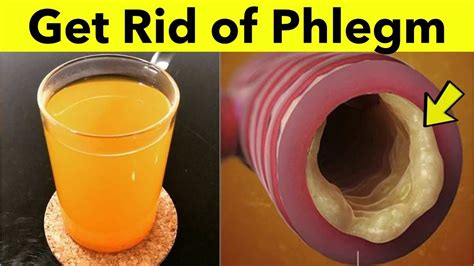 How To Get Rid Of Phlegm In Throat - Sheetfault34