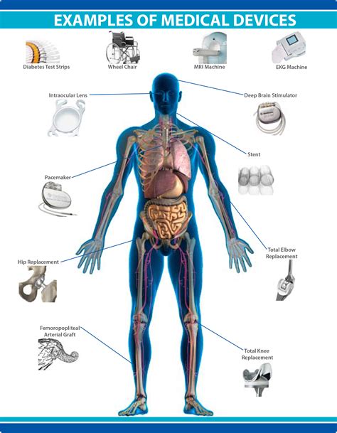 Medical Implants