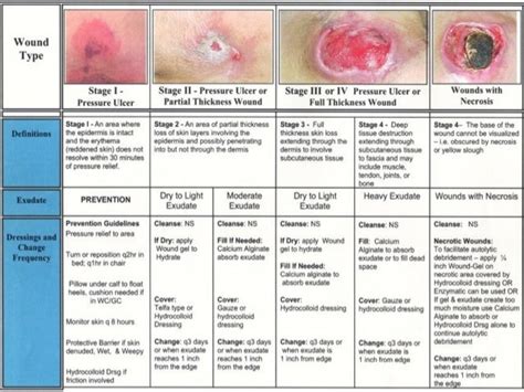 Pressure Injury; Causes, Symptoms, Diagnosis, Treatment - Rxharun