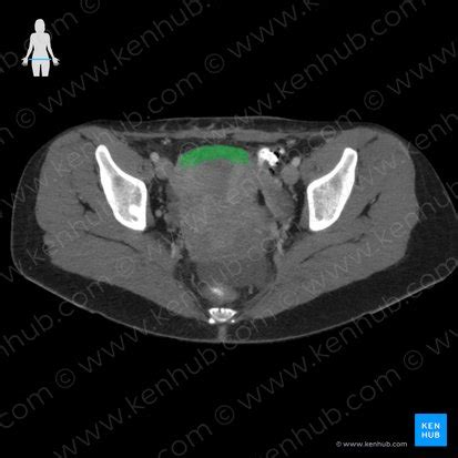 Fundus of uterus: Anatomy and function | Kenhub