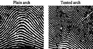 Forensic Training Unlimited | Arches--Fingerprint Pattern