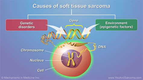 Understanding Soft Tissue Sarcoma