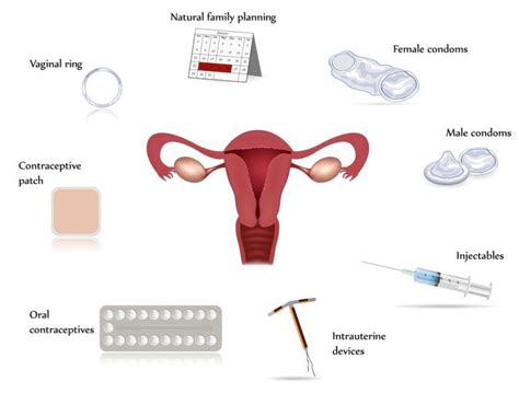 What are the different methods of contraception?