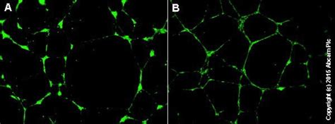 Angiogenesis Assay Kit (In Vitro) (ab204726) | Abcam