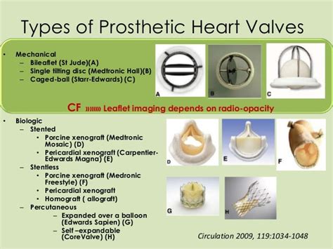 Role of cinefluoroscopy in prosthetic valve disease