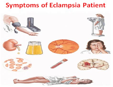 Pin on Nursing Exercise