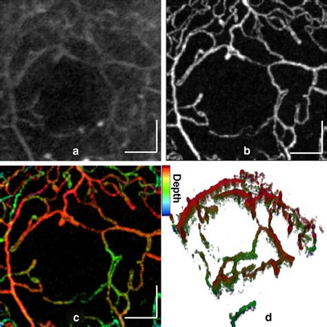 Retinal perfusion images of the parafoveal region, 1 1 mm 2 taken from ...