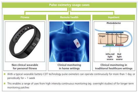 Case Study – Pulse Oximetry | Cambridge Display Technology