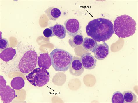 Mast Cell Histology