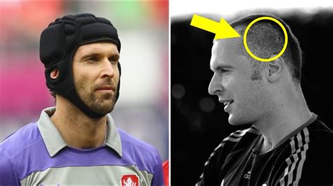 Petr Cech video accident and injury - This is why Petr Cech wears helmet!