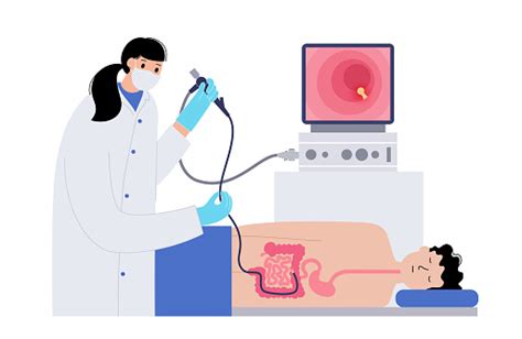 Colonoscopy Medical Procedure Stock Illustration - Download Image Now ...