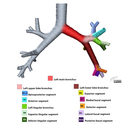 Image | Radiopaedia.org